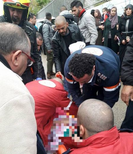 عرعرة ... اصابة طفلتين احداهما خطيرة بحادث دهس