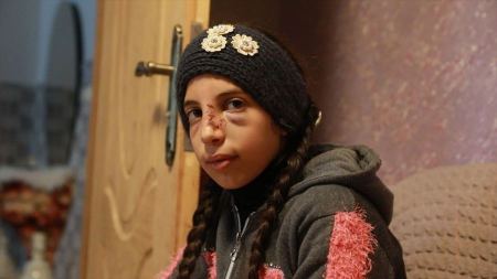 نجاة طفلة من محاولة خطف من قبل مستوطنين