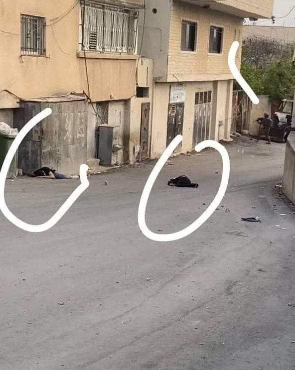 جنين : إصابتان حرجتان برصاص الاحتلال في اليامون