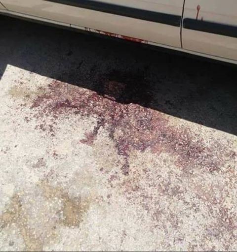 قتيل في قلقيلية بسبب شجار