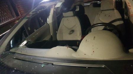 اصابة خطيرة لشاب من عرعرة تعرض لاطلاق نار