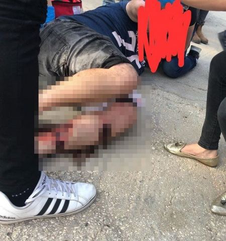 اصابة متوسطة لشاب من البعنة تعرض لاطلاق نار