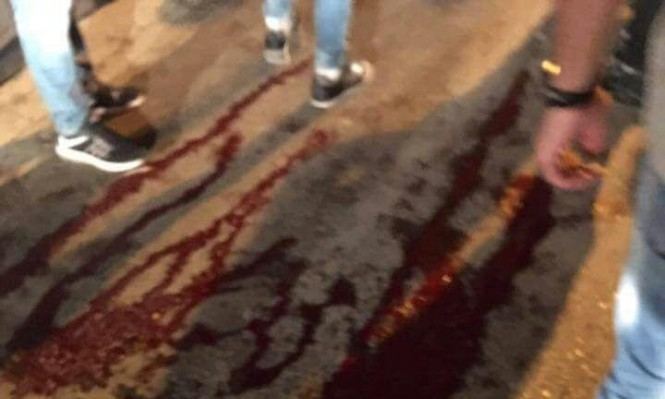 إصابة شاب من الطيبة تعرض لاطلاق نار