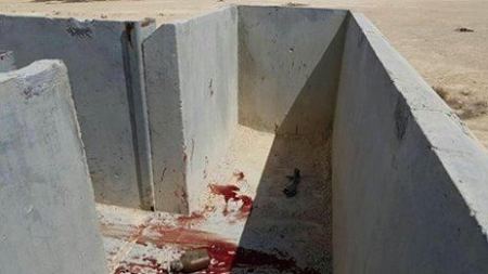 اصابة خطيرة لجندي اسرائيلي خلال التدريب 