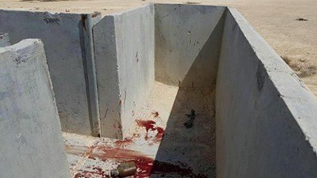 اصابة خطيرة لجندي اسرائيلي خلال التدريب