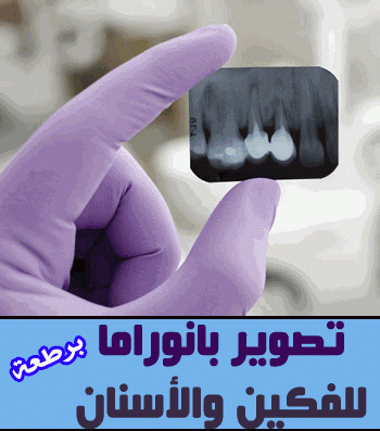 تصوير بانوراما للأسنان في عياده الدكتور اشرف كبها / برطعة