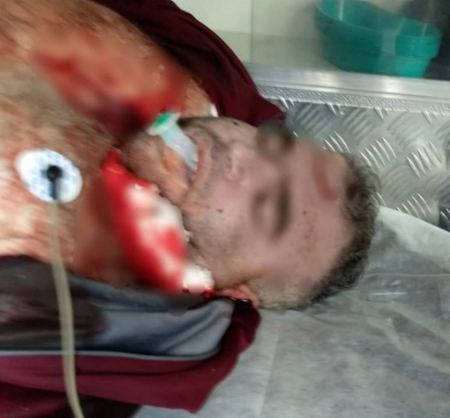 شهيد من الخليل بنيران الاحتلال بزعم تنفيذ عملية دهس