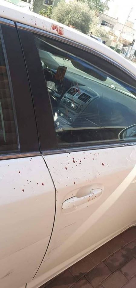 اصابة 3 شبان احدهم بحال الخطر جراء تعرضهم للطعن في الطيبة