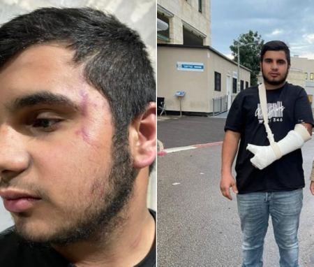 فتى من برطعة يتعرض للضرب المبرح من قبل الشرطة 