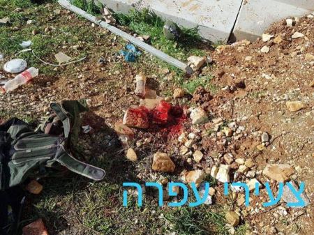 اصابة جندي للاحتلال رشقه شاب فلسطيني بحجر عن مستوطنة " بيت ايل"