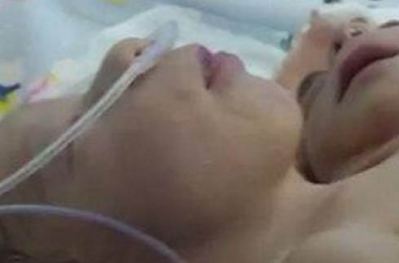 مصر : مولود برأسين وقلبين وثلاثة اذرع بعد 5 سنوات انتظار 
