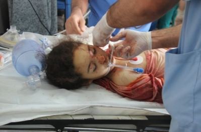 اول دفعة من جرحى غزة تصل تركيا للعلاج