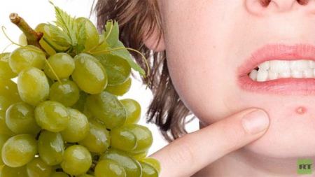 العنب هو المتسبب التاريخي الأول لحب الشباب 