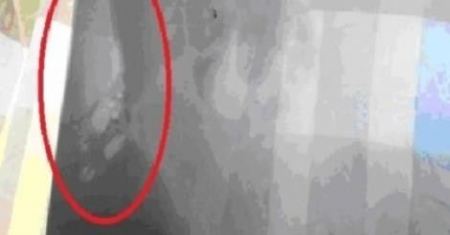 فيديو ... طبيب نسي هاتفاً ببطن مريضة في الاردن 