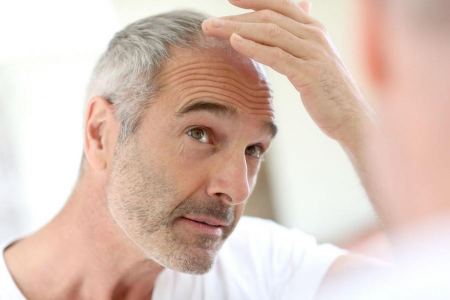 تركيا ... 100 ألف سائح يقومون بعملية زراعة الشعر في تركيا سنويا