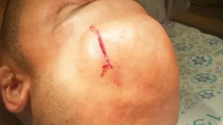 مستوطنون يعتدون بالضرب على مقدسيان في مكان عملهما
