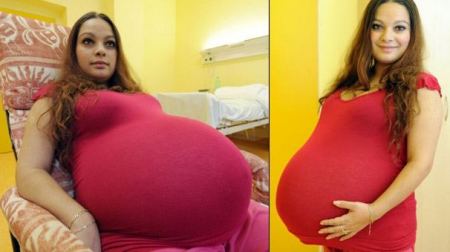 تشيكية ( 23 عاماً ) تضع 5 توائم بحمل طبيعي