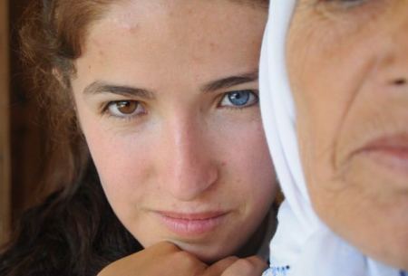 تركيا ... تباين في لون أعين أطفال بين البني والازرق