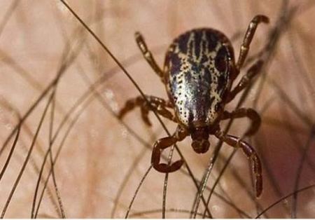 لدغة هذه الحشرة تسببت في بتر الاطراف الاربعة لـسيدة بريطانية