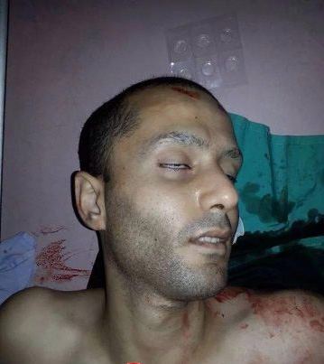 شهيدان في نابلس ورام الله اثر اقتحامات الليلة 