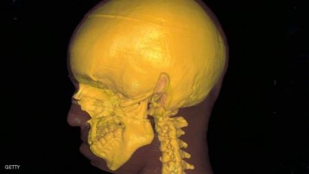 استخدام الحمض النووي لاعادة بناء الوجه