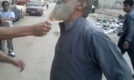 مصر ... فيديو .. شابان يشعلان النار في لحية مسنٍّ !