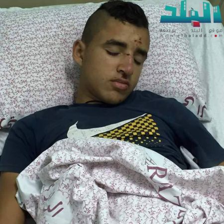 برطعة | اصابة متوسطة لـ فتى في منتزه الجمعية بحادث عمل