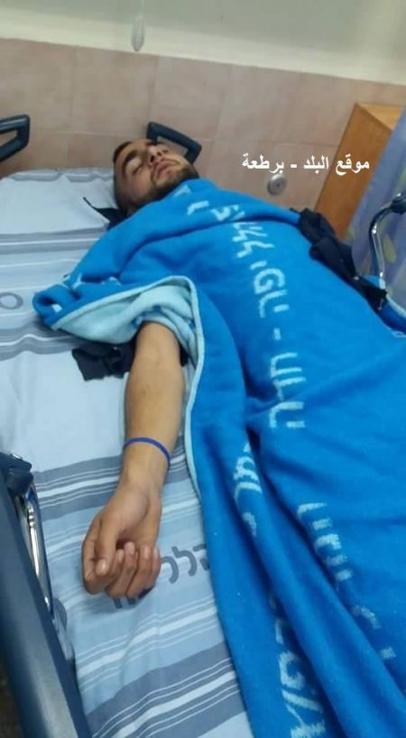 برطعة | اصابة محمد أمل كبها بحادث دهس 