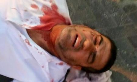 اعتداء عنصري وحشي على مواطن من اللد بعد خروجه من المسجد 