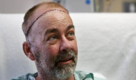 نجاح أول عملية من نوعها ... زراعة جمجمة وفروة رأس